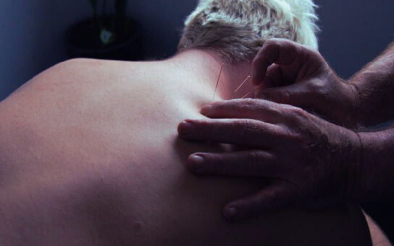 Dry needling in Altona, Williamstown, Brooklyn and Melbourne's Western Suburbs | Glenn Kinder Massage Therapy