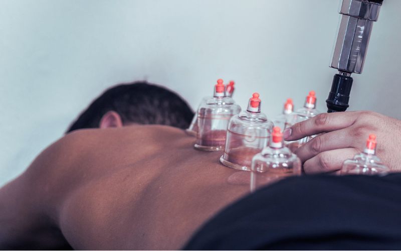Cupping therapy in Altona, Williamstown, Brooklyn and Melbourne's Western Suburbs | Glenn Kinder Massage Therapy